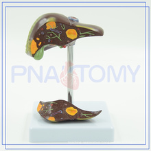 PNT-0752 liver diseased model for wholesale